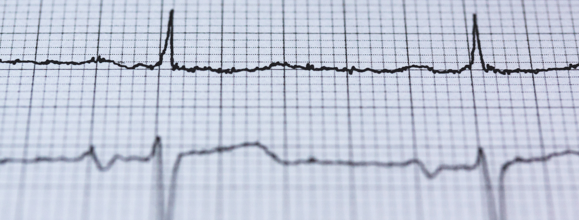 Heart monitor printout
